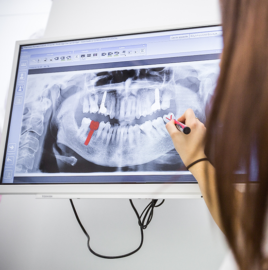 Dentist showing a patient an x ray of their teeth