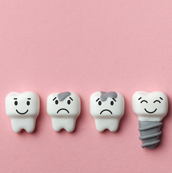 Illustration of a smiling dental implant next to frowning natural teeth