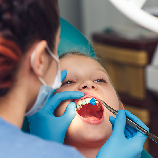 Child in the dental chair having fluoride applied to their teeth