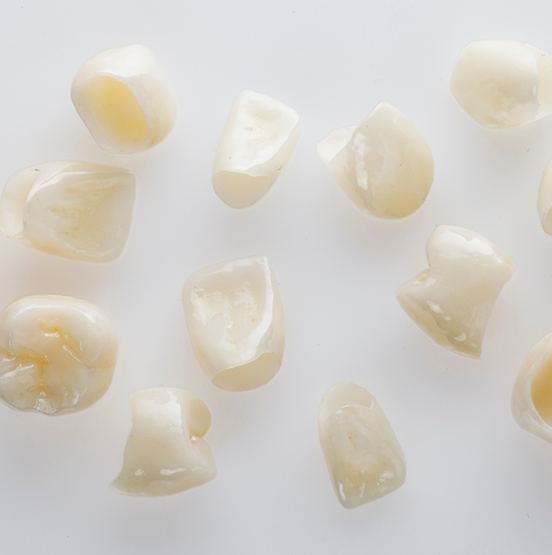 Several tooth-colored dental crowns