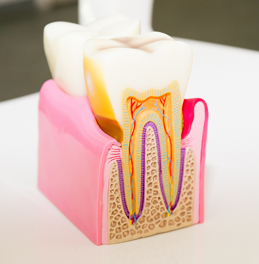 Model of a tooth showing the root canals inside of it