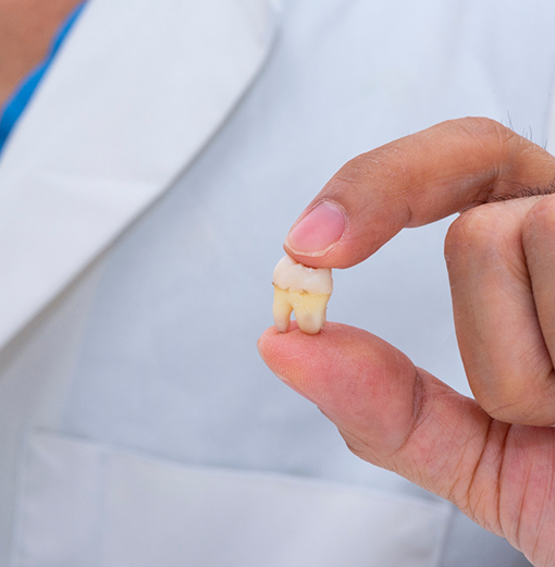 Dentist holding an extracted tooth